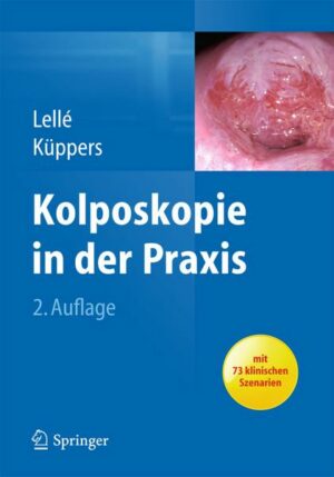 Kolposkopie in der Praxis