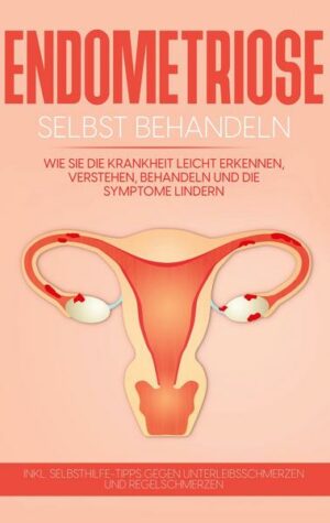 Endometriose selbst behandeln: Wie Sie die Krankheit leicht erkennen