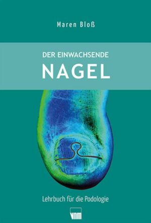 Der einwachsende Nagel