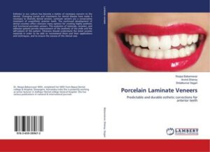 Porcelain Laminate Veneers