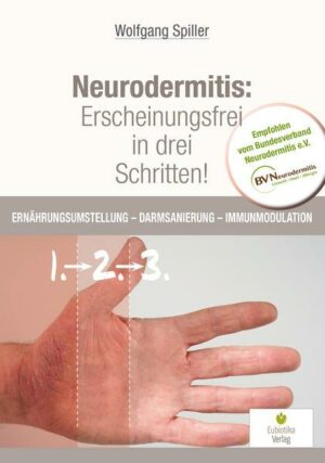 Neurodermitis: Erscheinungsfrei in drei Schritten!