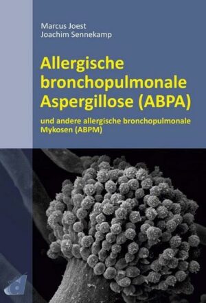Allergische bronchopulmonale Aspergillose (ABPA)