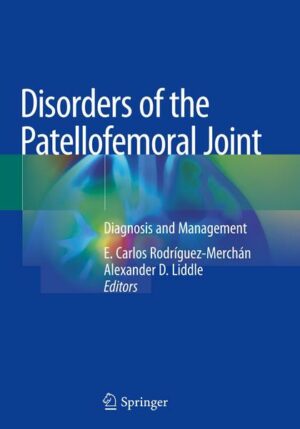 Disorders of the Patellofemoral Joint