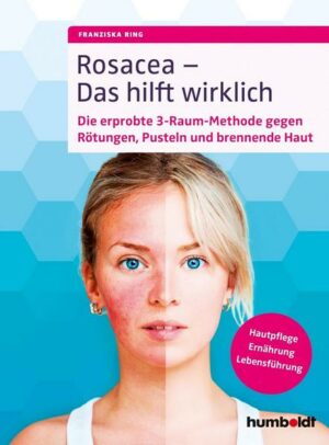 Rosacea – Das hilft wirklich