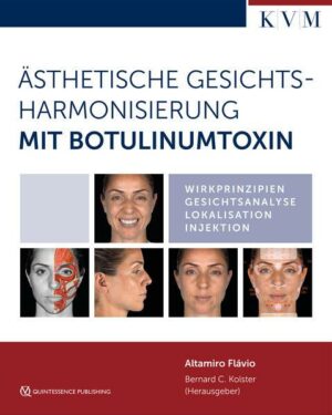 Ästhetische Gesichtsharmonisierung mit Botulinumtoxin