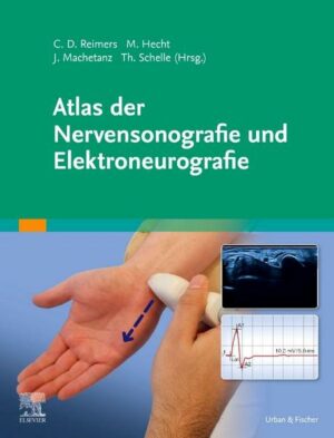 Atlas der Nervensonografie und Elektroneurografie