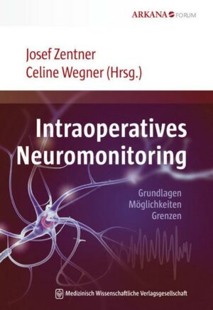 Intraoperatives Neuromonitoring