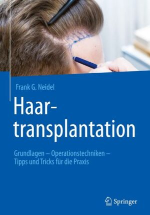 Haartransplantation