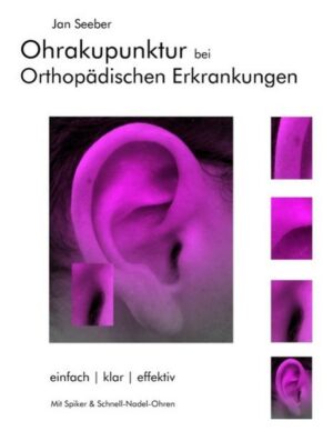 Ohrakupunktur bei Orthopädischen Erkrankungen