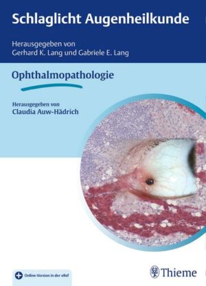 Schlaglicht Augenheilkunde: Ophthalmopathologie