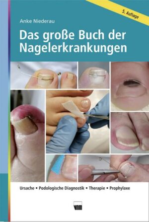 Das große Buch der Nagelerkrankungen