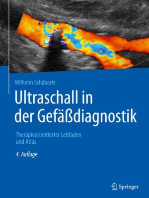 Ultraschall in der Gefäßdiagnostik