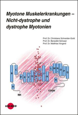 Myotone Muskelerkrankungen – Nicht-dystrophe und dystrophe Myotonien