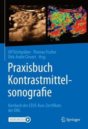 Praxisbuch Kontrastmittelsonografie