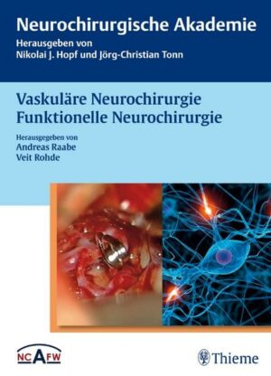 Vaskuläre Neurochirurgie Funktionelle Neurochirurgie