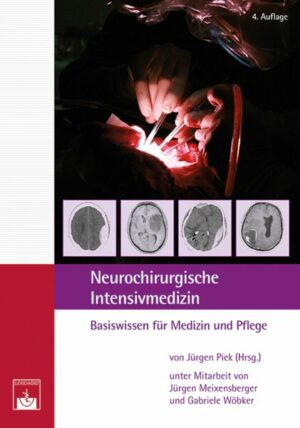 Neurochirurgische Intensivmedizin