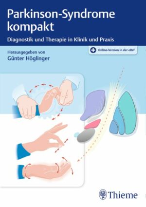 Parkinson-Syndrome kompakt